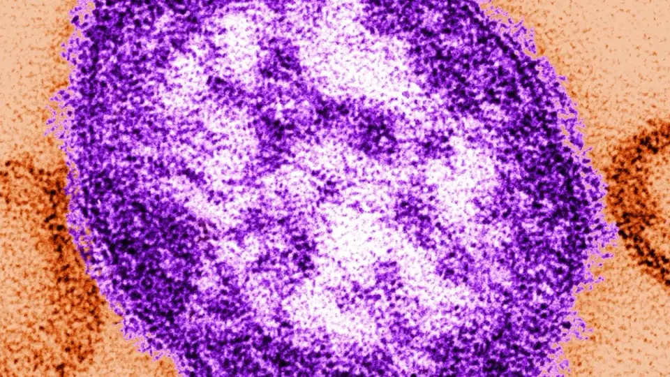 Bangor measles signal from wastewater prompts vaccination push