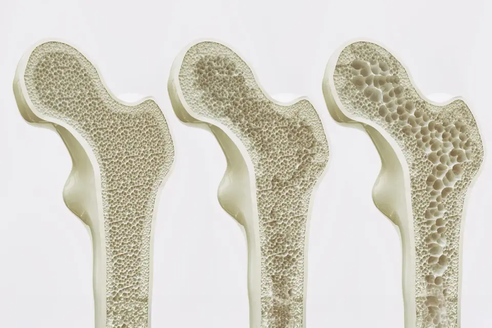 GPR133 Receptor Emerges as a New Target to Strengthen Bones