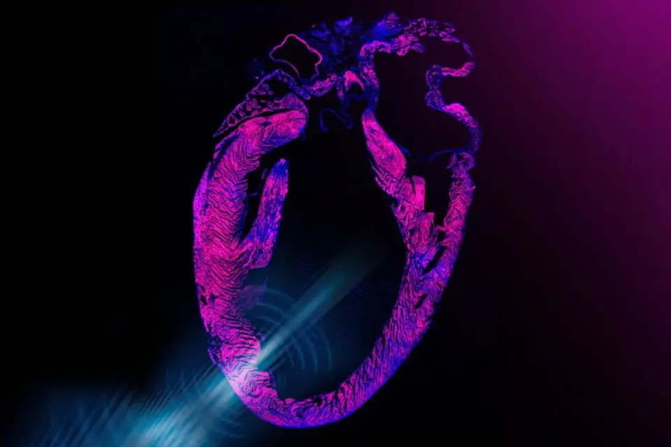 MIT's Wearable Ultrasound Patch Paces the Heart Without Surgery