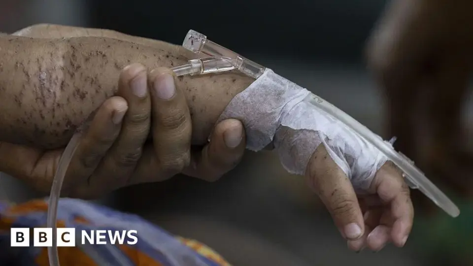Bangladesh’s Measles Crisis Deepens as Vaccination Delays Leave Children at Risk