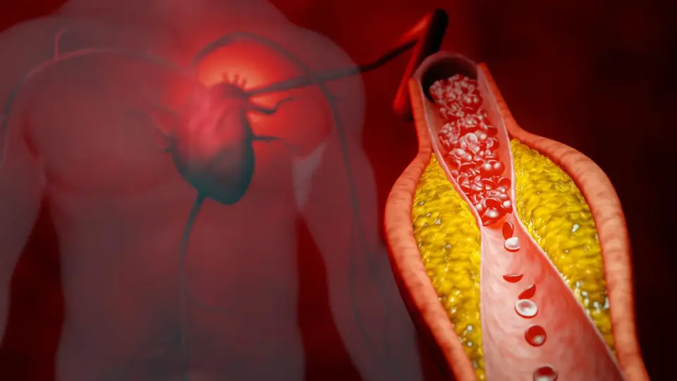 DNA-powered therapy halves 'bad' cholesterol, bypassing statins
