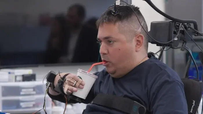 Bidirectional brain implant restores hand movement and touch in quadriplegia
