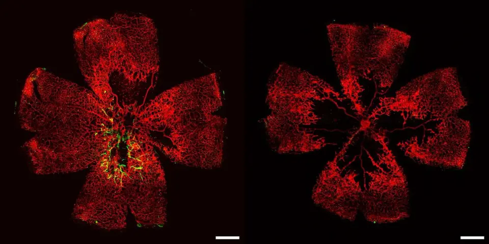 Lab-grown retinal vessels restore function in mice, fueling hope for blindness treatments