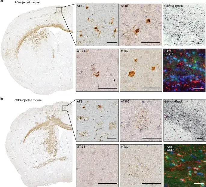 Human Tau Strains Retain Structural Identity in Mouse Brains, Validating Prion-Like Transmission