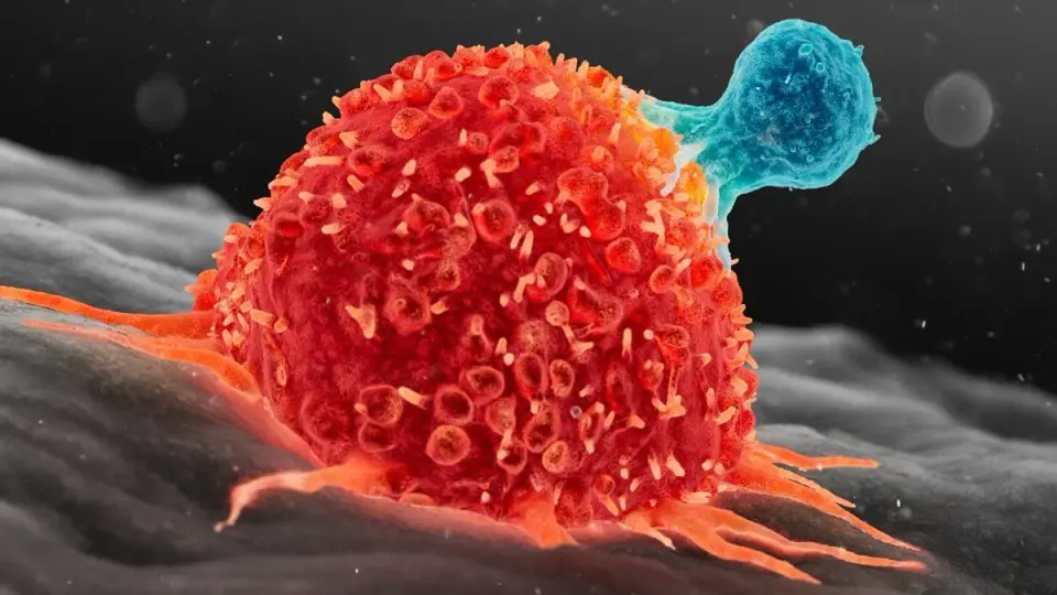 Three-Year-Old Achieves Complete Remission of Metastatic Liver Cancer via Experimental CAR T-Cell Therapy