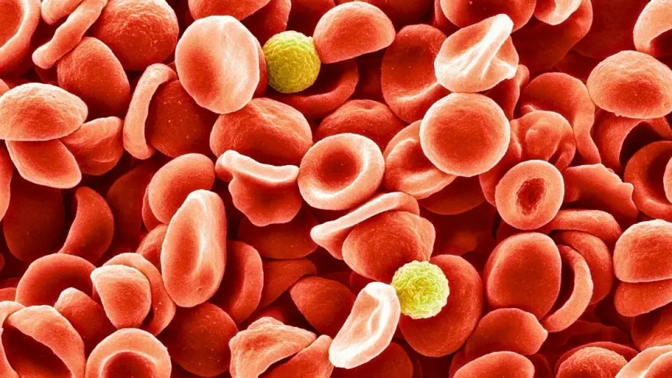 Stress in Minutes: Acute Anxiety Reconfigures Blood Clots