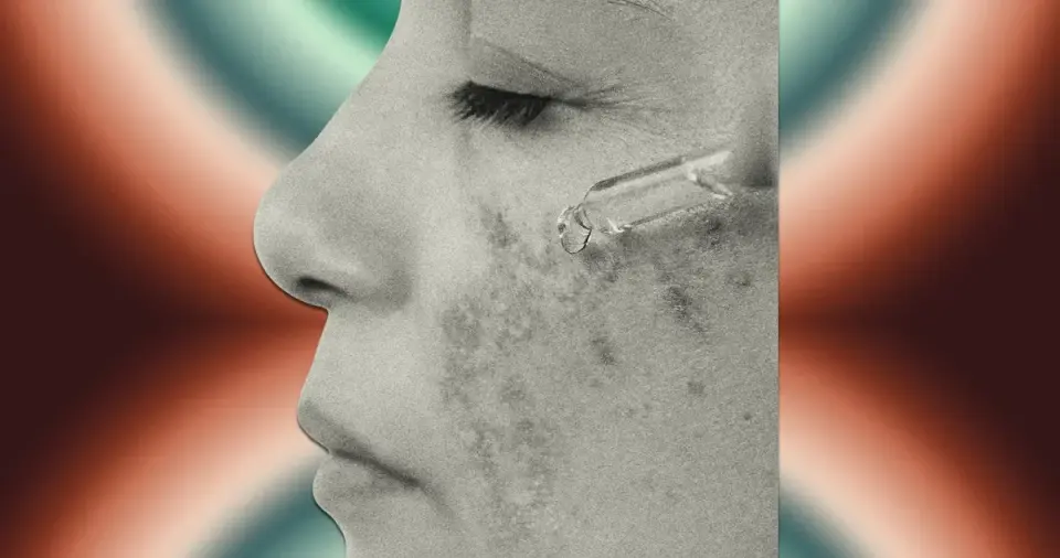 Melasma Makeover: Practical At-Home Regimens to Fade Spots