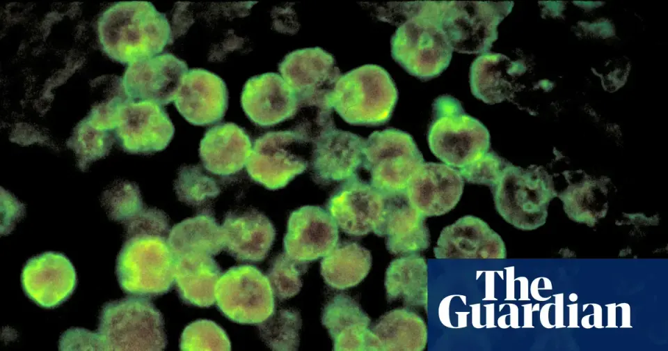 North Carolina teen Moises Ponce Mendoza dies of rare Naegleria fowleri infection