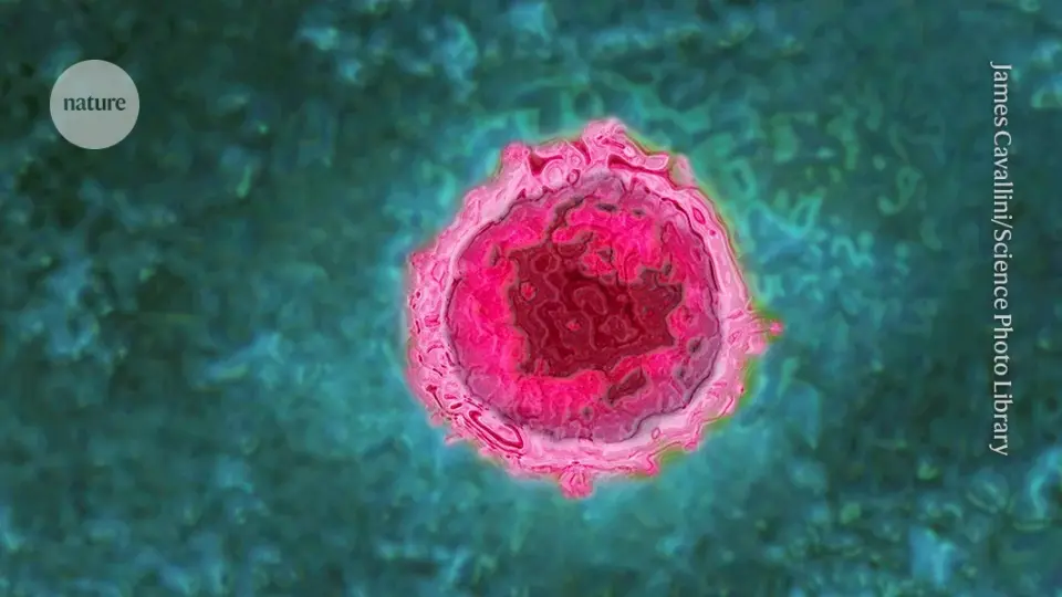 Severe COVID-19 May Trigger Dormant Viruses, Tied to Long COVID