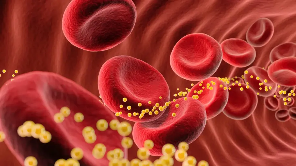 One-shot gene-editing therapy reduces LDL by up to 62% in early trial