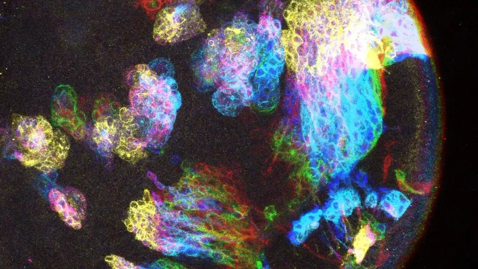 Developmental State May Explain Why Brain Regions Are More Cancer-Prone