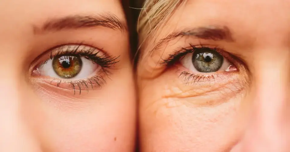 Five Signals Your Skin Is Aging Gracefully