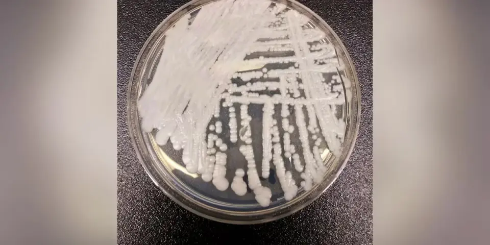 Drug-Resistant Fungus Candida auris Spreads Across 26 States