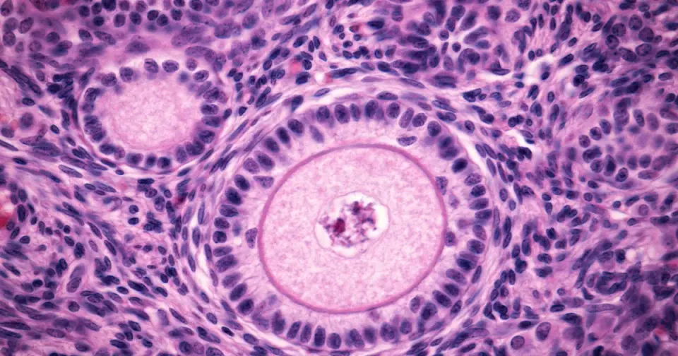 Postmenopausal Ovaries Remain Biologically Active, Linking Aging to Cancer Risk
