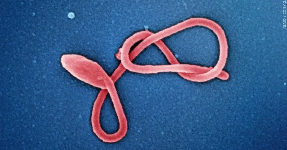 Milwaukee Health Dept Monitors 3 for Ebola; risk deemed very low