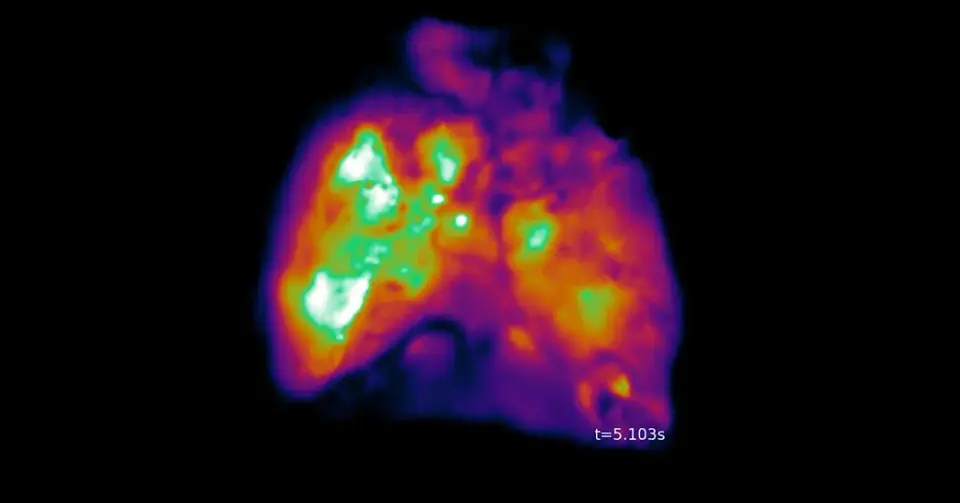 Mice with Human Neurons Raise Ethical Questions