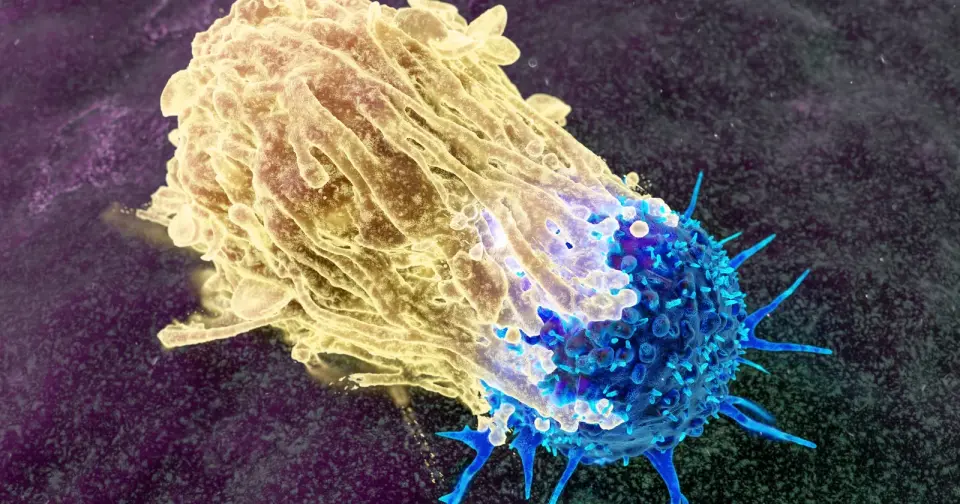 When cancer hides MHC I, NK cells may strike back