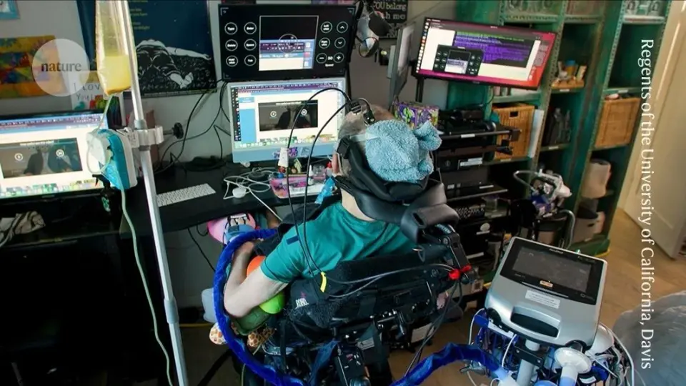 Home Brain Implant Restores Speech and Computer Use for ALS Patient