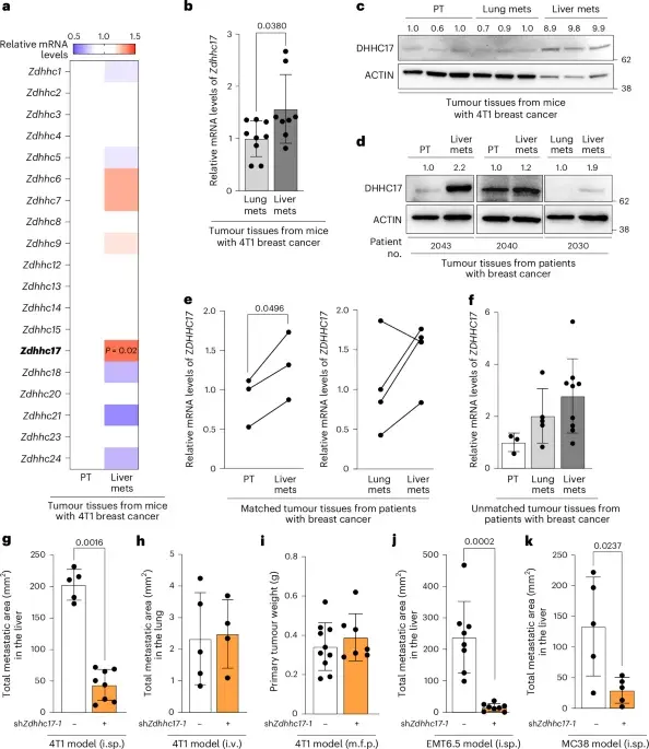 Liver palmitate fuels metastasis by dampening neutrophil attack through laminin-511 palmitoylation