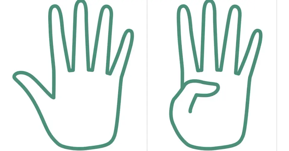 Thumb Test Hints at Aortic Risk, But Isn’t Diagnostic