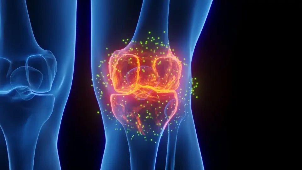 Yale Study Finds Epilepsy Drug Lacosamide May Reverse Osteoarthritis via Targeted Hydrogel Delivery