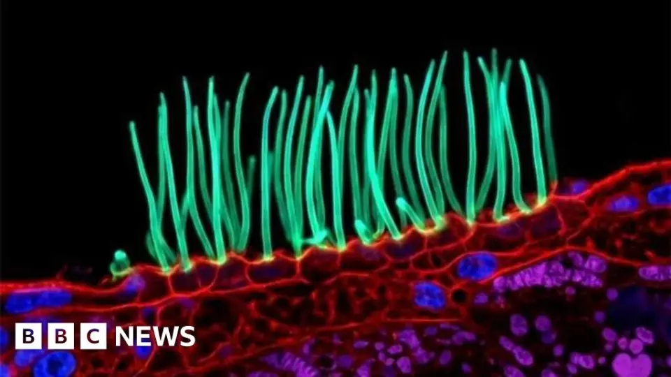 Nikon Disqualifies Microscopy Winner After AI Fabrication Scandal