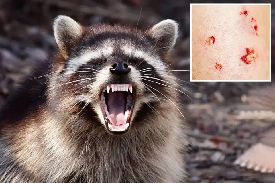 First Rabid Raccoon in LA County in 50 Years Triggers Public Health Alert