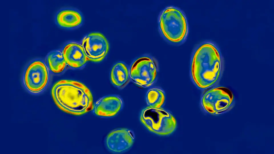 CDC Report: Drug-Resistant Germs Cause 9.7 Million US Infections Annually