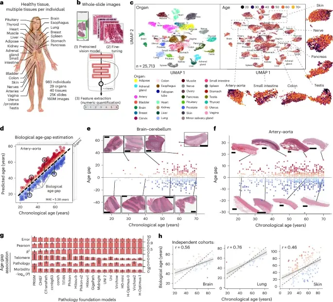 Histology-based tissue clocks reveal organ-specific aging patterns and disease signals