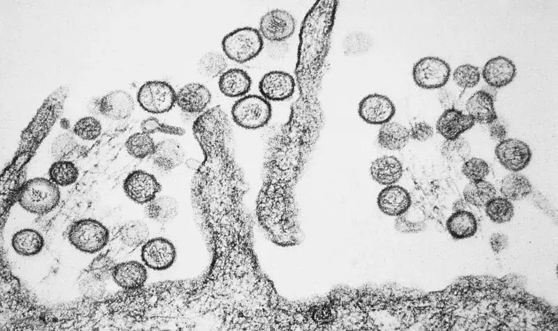 Hantavirus on cruise ship prompts seven cases, three deaths off Cabo Verde