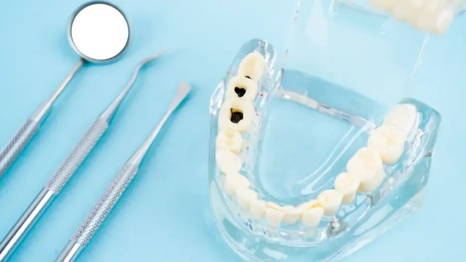 Liquid Fluoride Arrests Cavities in Young Children, Large Trial Finds