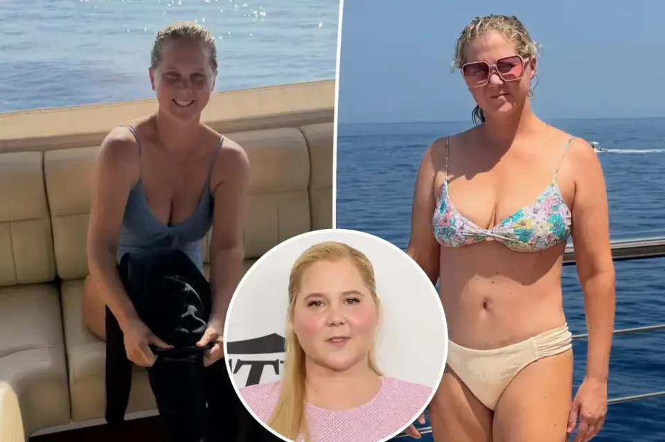 Amy Schumer debuts 50-pound weight loss in unfiltered bikini yacht photos