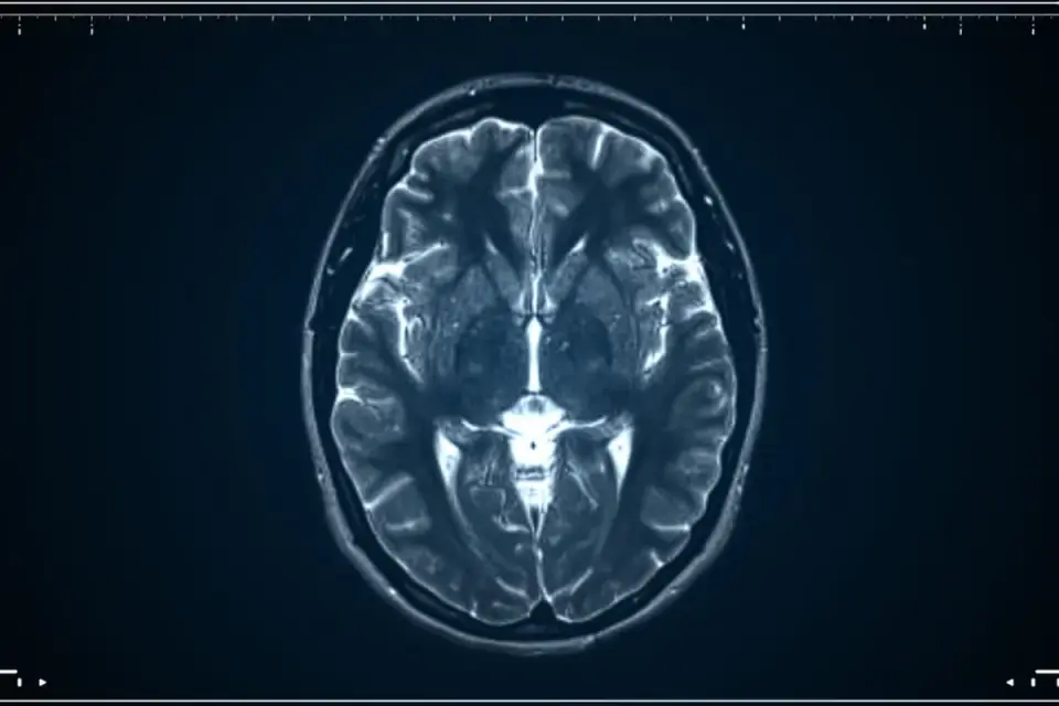 Stanford Study Reveals Brain Develops from Two Distinct Progenitor Lines