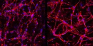 Stem-derived retinal vessels repair damaged retinas in mice, paving way for new eye therapies