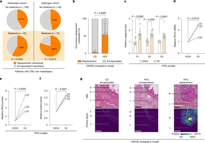 Fatty liver steatosis shifts colorectal cancer liver metastases toward aggressive replacement pattern via MYC–proline–collagen axis