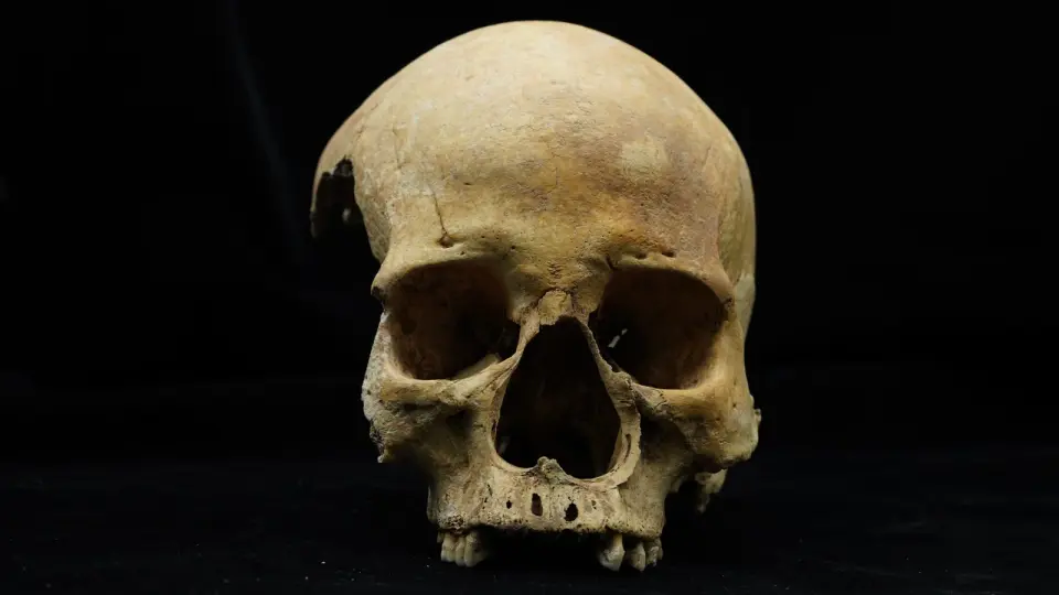 Archaeologists Identify First Physical Evidence of Punitive Nose Amputation in 14th-Century China