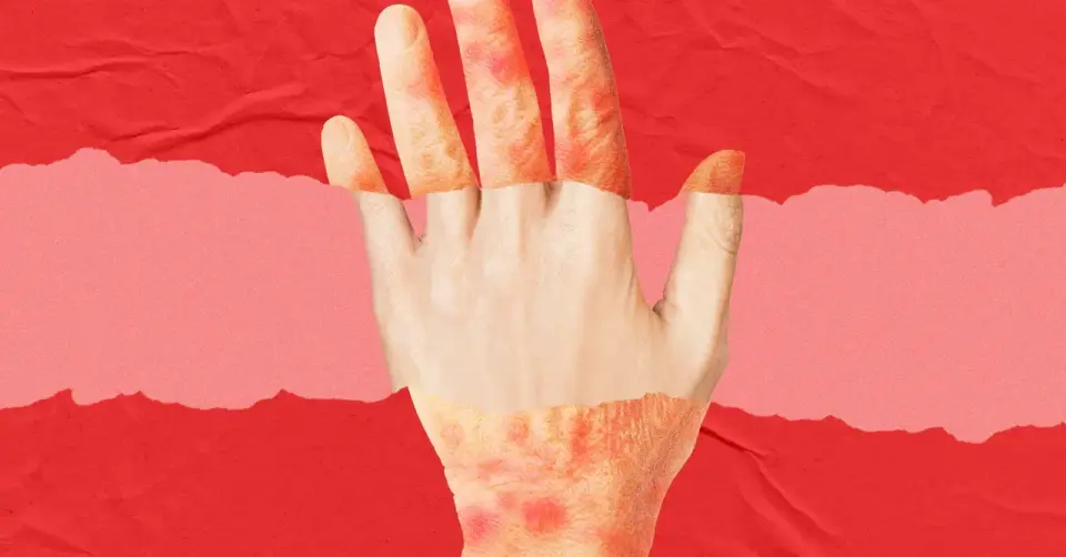 Rubedo’s Topical Cream Cuts Skin Biological Age by Two Years in Early Trial