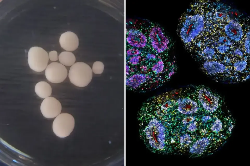 Seven-year lab-grown brain organoids reveal time-keeping in a dish