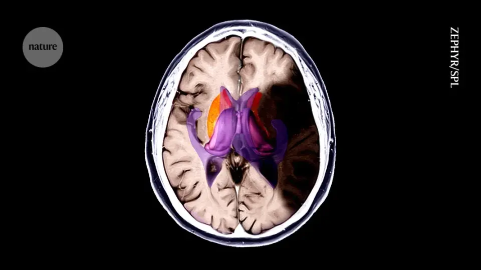 Cool combo shields mouse brains from stroke damage by slowing metabolism