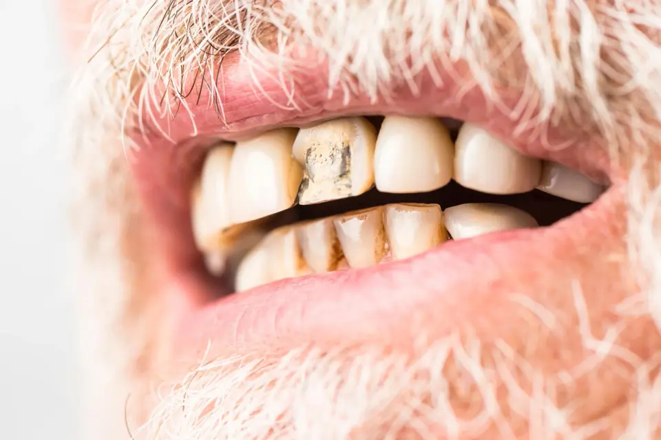 Two Stem-Cell Pathways Could Enable Real Tooth and Jawbone Regrowth