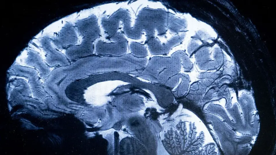 Midlife Brain Remodeling Rewrites Immune Landscape, Linking to Inflammation and Dementia Risk