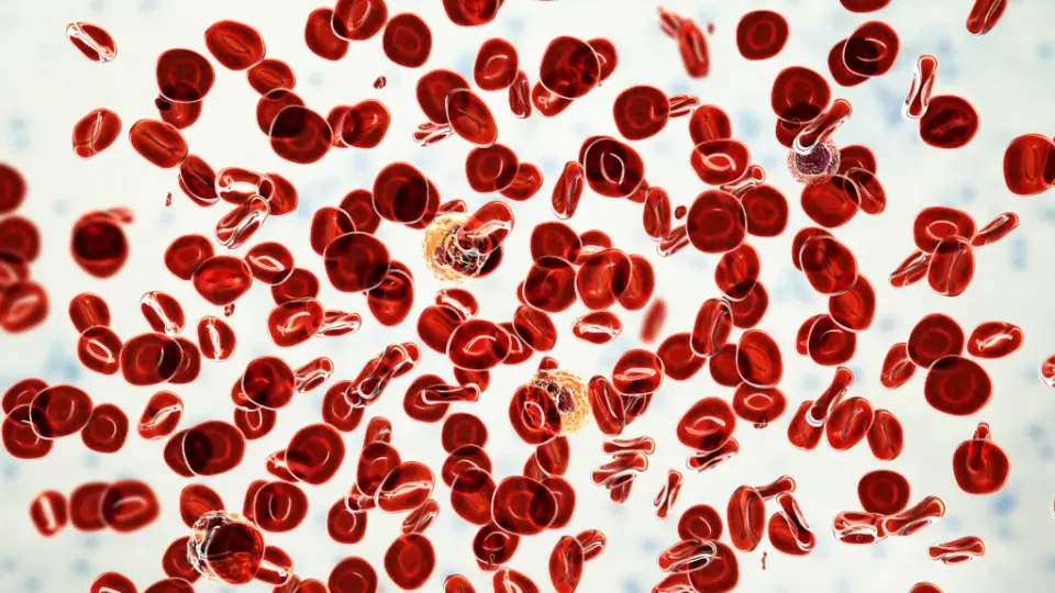Silence Therapeutics' divesiran shows strong Phase 2 signals in polycythemia vera