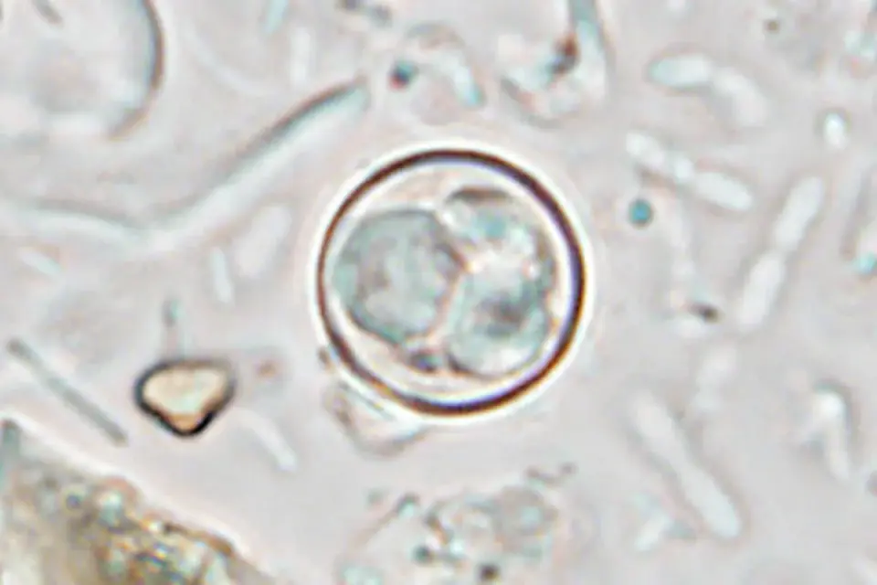 Cyclospora parasite drives US-wide diarrheal outbreak, CDC reports