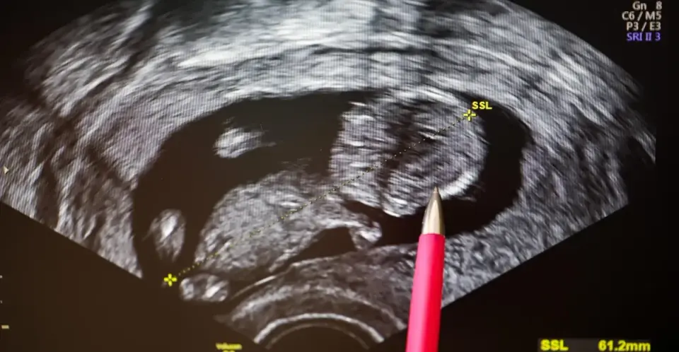 Preimplantation genetic testing expands beyond rare diseases to predict common health risks