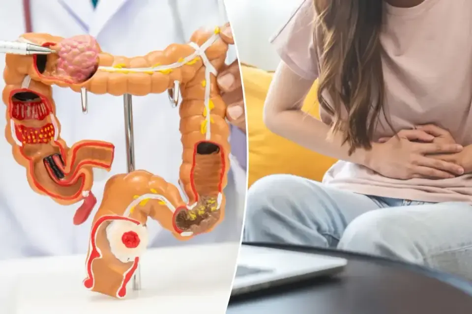 Teen Colorectal Cancer Rates Surge, but Late Diagnoses Lead to High Mortality