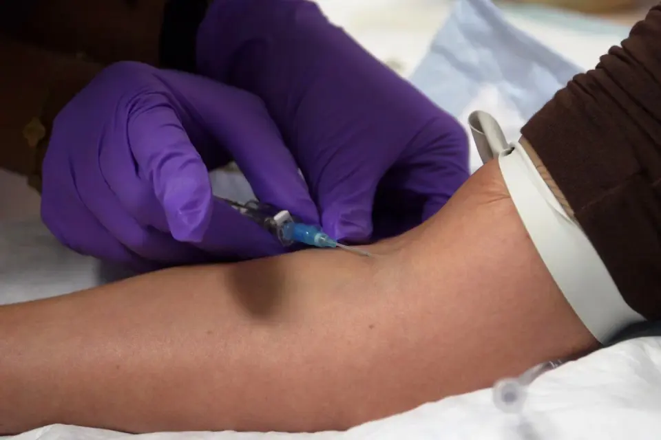FDA Weighs Temporary Peptide Sales Amid Safety Concerns