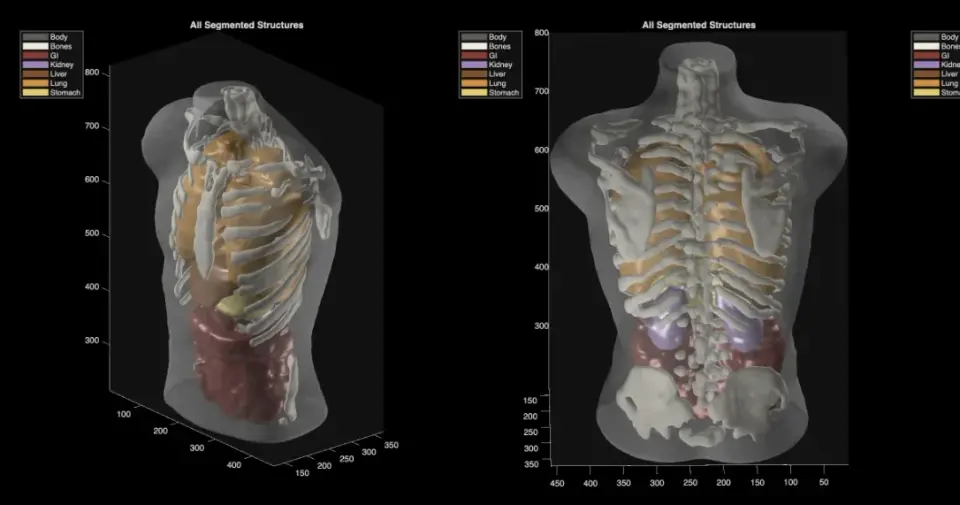 Midjourney Expands from AI Art to MRI-Style Full-Body Ultrasound Scans