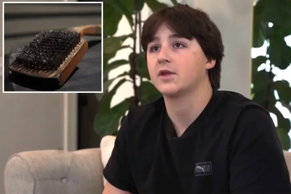Minnesota teen’s burger hides a grill-bristle, prompting emergency surgery