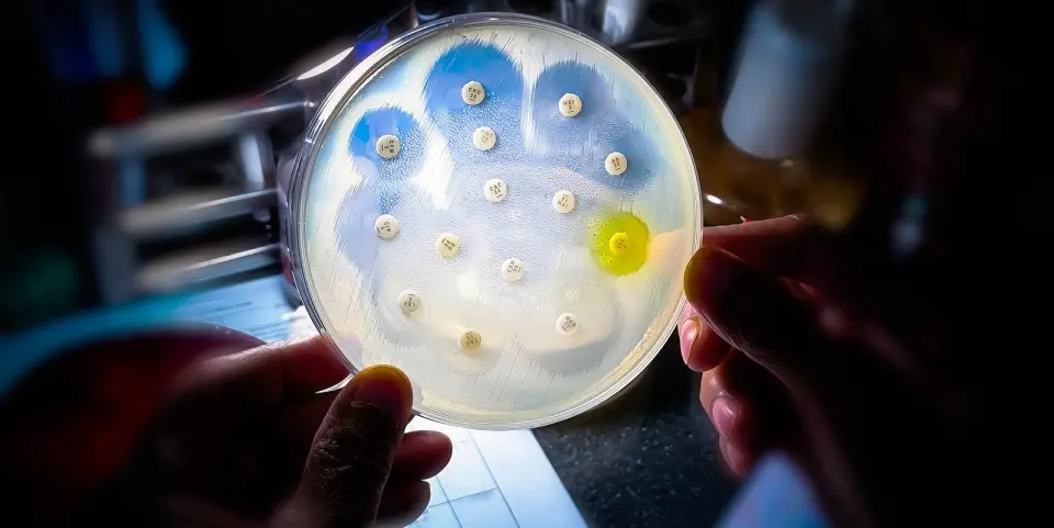 Global AMR wave: common infections resisting antibiotics worldwide
