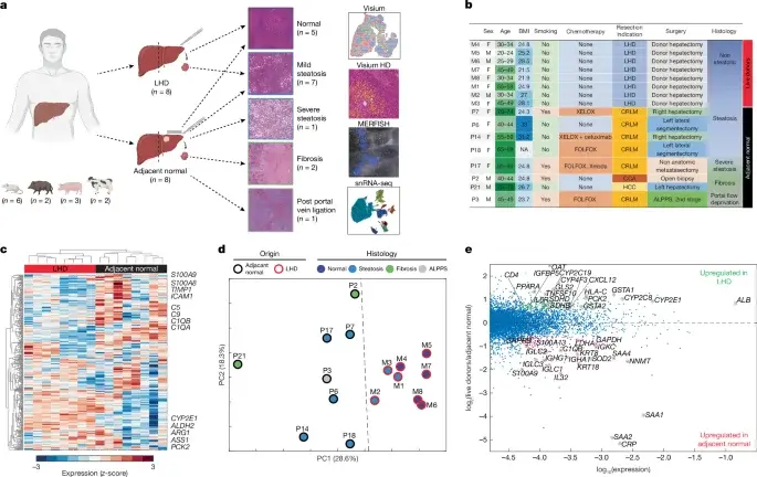 Live-donor atlas maps healthy liver zonation and early steatosis dynamics